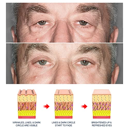 Men’s anti-fatigue eye cream for dark circles and puffiness – KSA